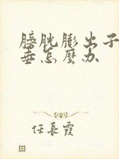 膀胱膨出子宫脱垂怎么办