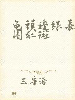 龟头边缘长了一圈红斑