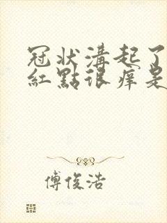 冠状沟起了好多红点很痒是怎么回事