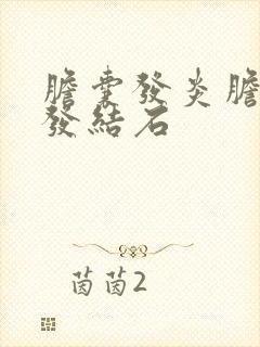 胆囊发炎胆囊多发结石