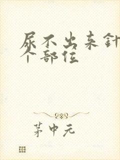 尿不出来针灸哪个部位