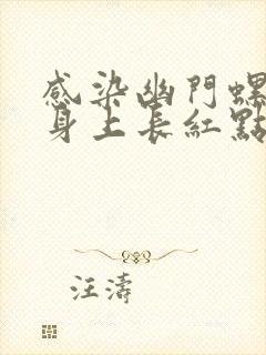 感染幽门螺杆菌身上长红点是什么原因