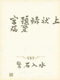 宫颈鳞状上皮内病变