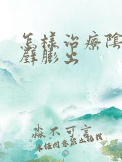 怎样治疗阴道前壁膨出