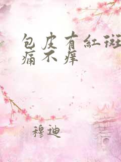 包皮有红斑 不痛不痒