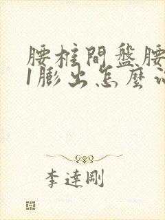 腰椎间盘腰5骶1膨出怎么治疗