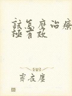 该怎么治疗抑郁极有效