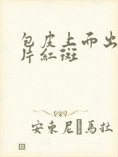 包皮上面出现一片红斑