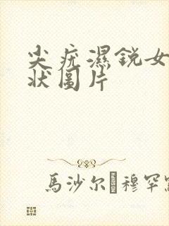 尖疣湿锐女性症状图片