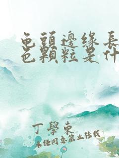 龟头边缘长的白色颗粒是什么