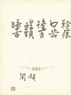 睡醒后口干口苦舌头有齿痕