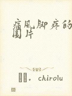 痛风脚疼的位置图片