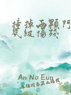 撞掉两颗门牙算几级伤残