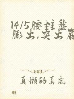 l4/5腰椎盘膨出,突出严重吗?