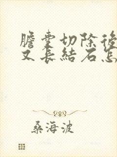 胆囊切除后胆管又长结石怎么办