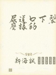 尿道口下裂是怎么样的