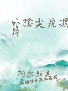 外阴尖疣湿锐图片