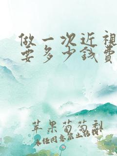 做一次近视手术要多少钱费用