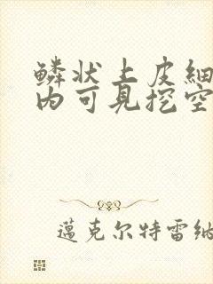 鳞状上皮细胞层内可见挖空细胞