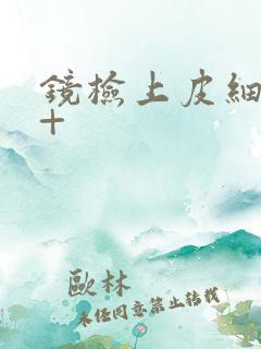 镜检上皮细胞2+