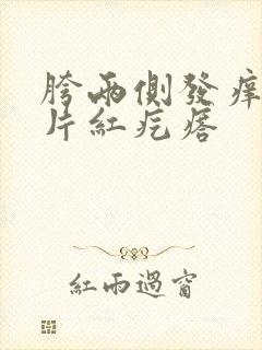 胯两侧发痒起大片红疙瘩