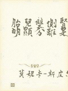 胎儿双侧肾盂无明显分离是什么意思