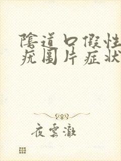 阴道口假性湿锐疣图片症状