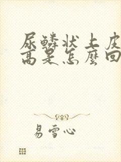 尿鳞状上皮细胞高是怎么回事