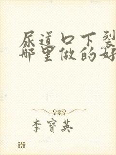 尿道口下裂手术哪里做的好