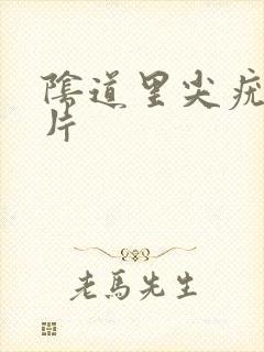 阴道里尖疣锐图片