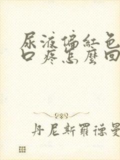 尿液偏红色尿道口疼怎么回事