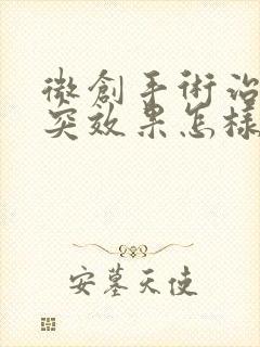 微创手术治疗腰突效果怎样