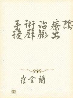 手术治疗阴道前后壁膨出