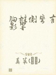 胸椎侧弯有什么影响