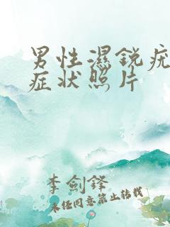 男性湿锐疣图片症状照片