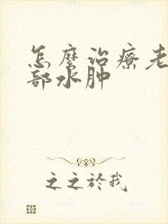 怎么治疗老人腿部水肿