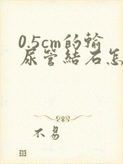 0.5cm的输尿管结石怎么治疗