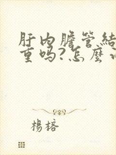 肝内胆管结石严重吗?怎么治疗