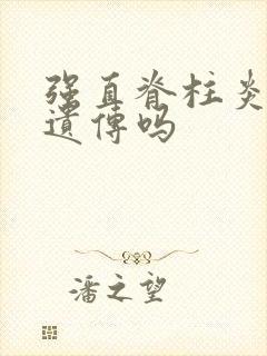 强直脊柱炎的会遗传吗