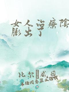 女人治疗阴道壁膨出了