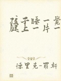 孩子睡一觉起来腿上一片一片红块