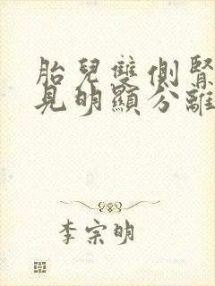 胎儿双侧肾盂未见明显分离是男女