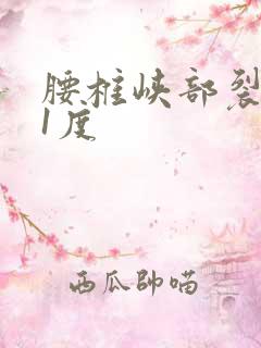 腰椎峡部裂滑脱1度