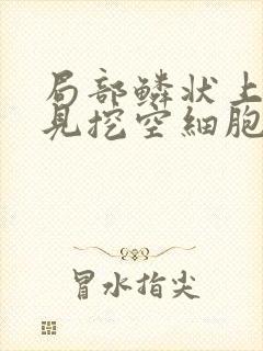 局部鳞状上皮内见挖空细胞