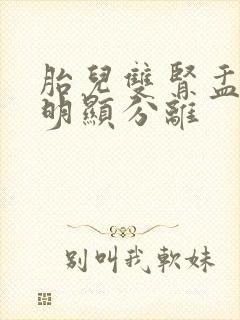 胎儿双肾盂未见明显分离