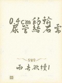 0.4cm的输尿管结石需要碎石吗