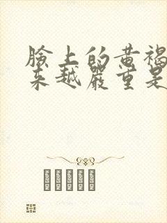 脸上的黄褐斑越来越严重是怎么回事