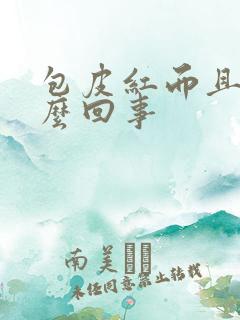 包皮红而且痒怎么回事