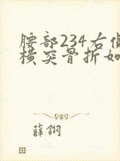 腰部234右侧横突骨折如何调养