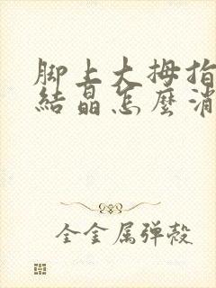 脚上大拇指痛风结晶怎么消除